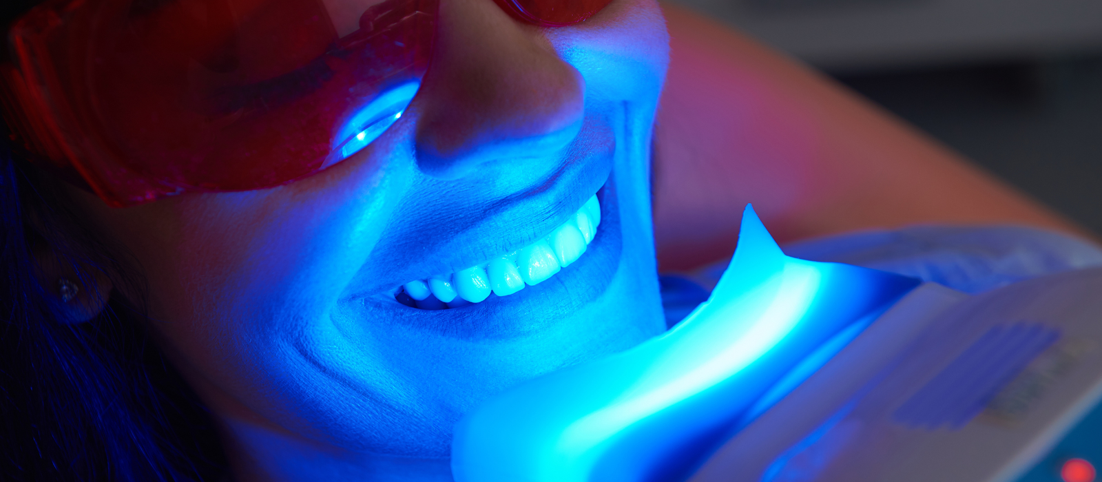 Paciente realizando clareamento dental a laser na Prime Saúde Oral.