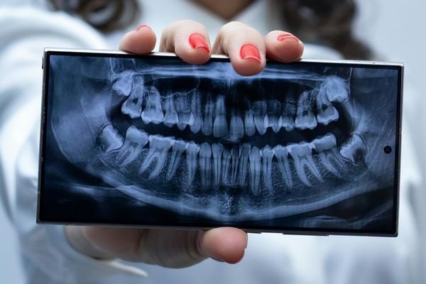 Tratamento periodontal para gengivas saudáveis na Prime Saúde Oral em Alphaville