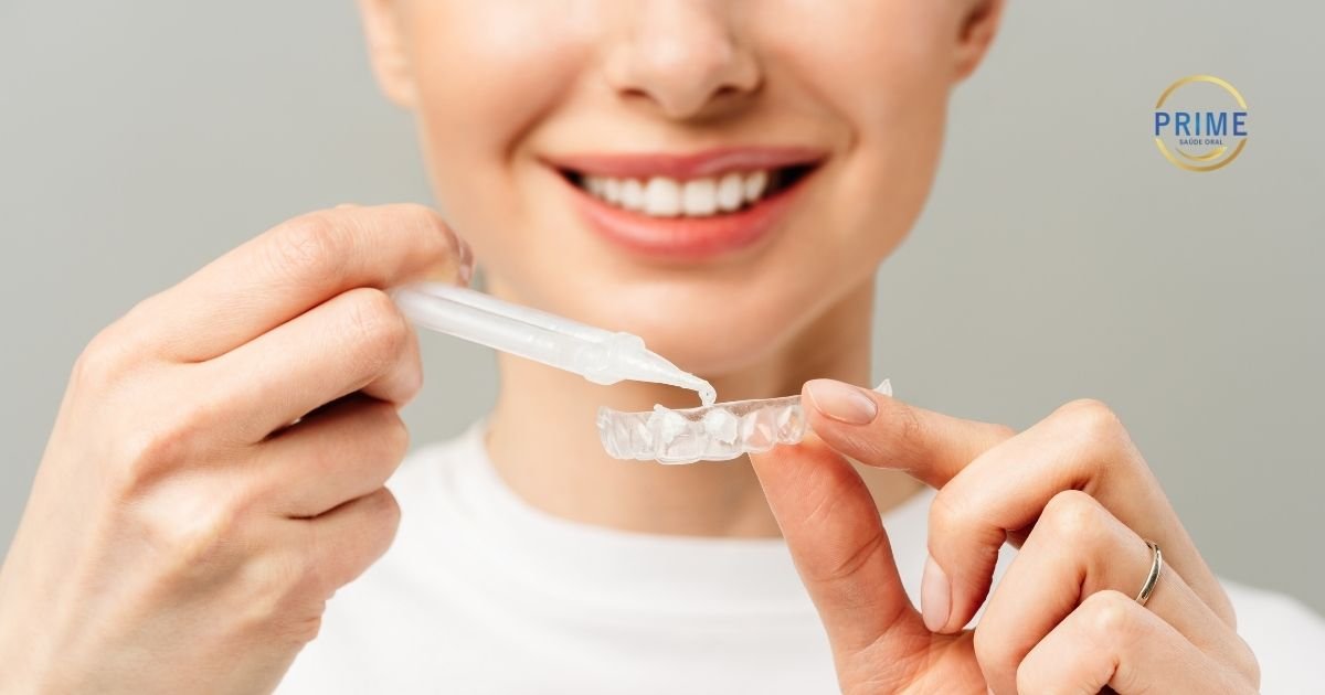 Close-up das mãos de uma mulher aplicando o gel clareador com uma seringa dentro de uma moldeira de silicone transparente.