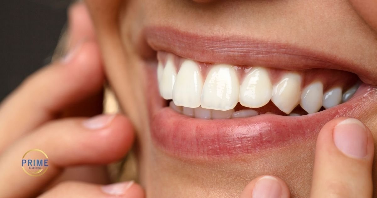 Comparativo visual mostrando uma lente de contato dental ultrafina sobre a ponta de um dedo e uma faceta de porcelana mais espessa ao lado.