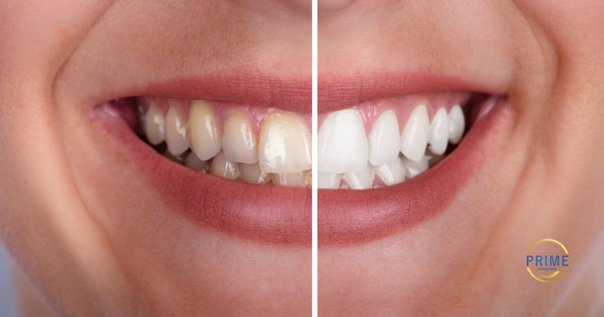 Moça jovem de blusa branca sorrindo e celebrando com o logotipo dourado da Prime Saúde Oral, exibindo dentes brancos e alinhados.