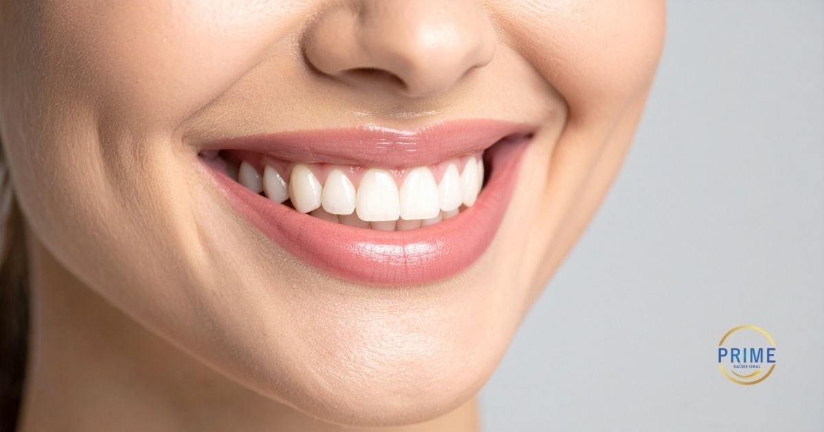 Scanner intraoral de alta tecnologia realizando o mapeamento digital para criação de lentes de contato dental na Prime Saúde Oral.