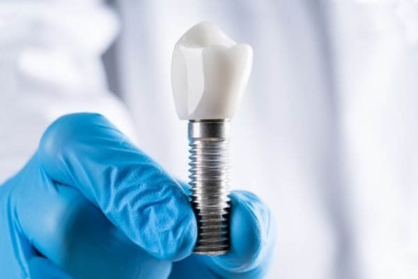 Prime Saúde Oral — Clínica de implantes dentários em Alphaville
