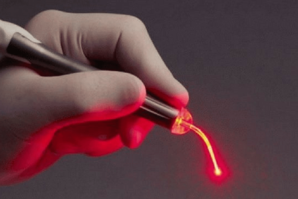 Paciente recebendo tratamento de Laserterapia indolor na Prime Saúde Oral.