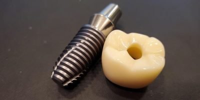 Solução moderna e segura para quem deseja resultados imediatos.